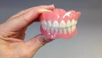 Implant Supported Denture