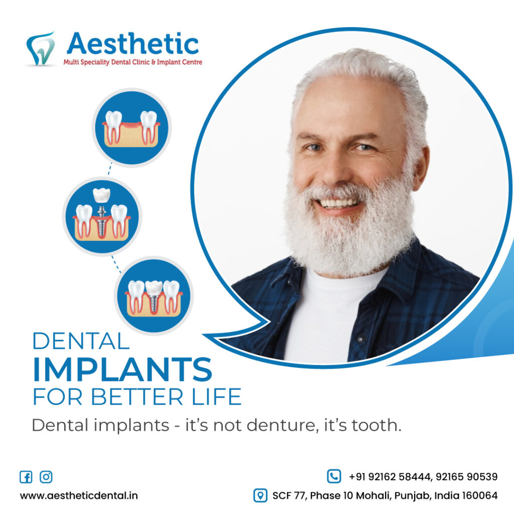 Dental Implants at Aesthetic Dental Multi Speciality Dental Clinic & Implant Centre in Mohali Punjab Chandigarh Tricity.