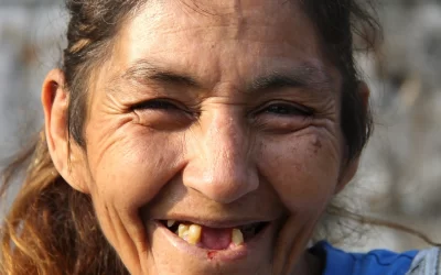 Ignoring a Missing Tooth? Learn Why You Shouldn’t!