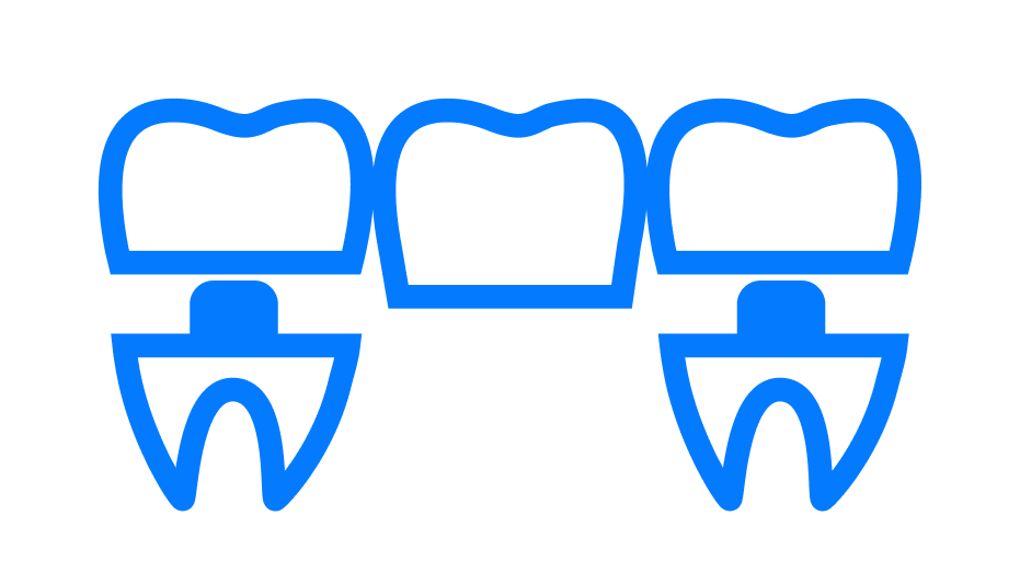 Dentures and Bridges Tooth Restoration icon showing broken tooth which chould be restored by dentist in mohali